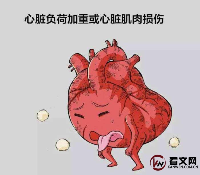 心肌炎