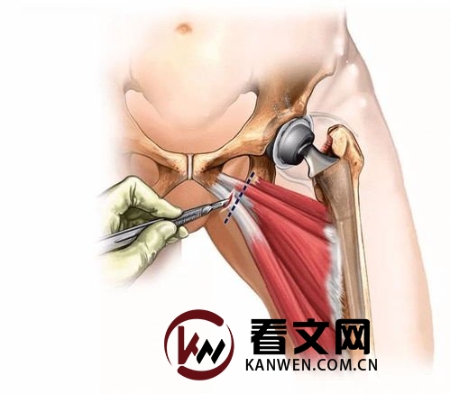 大腿根内侧靠近私部疼痛是怎么回事